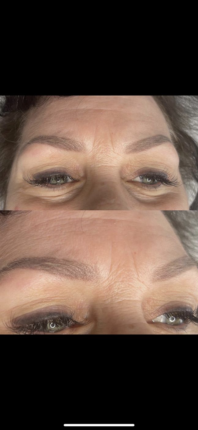 A before and after picture of a woman 's eyebrows.